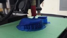 3D Kidney model print 